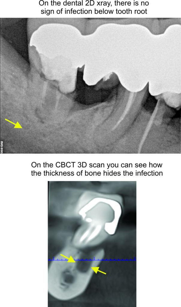 Cbct Scan Example Dental Clearance (AOEE™) CBCT Scan - ORAL SYSTEMIC EVALUATION CENTER